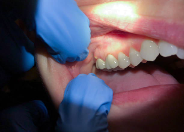 Best Cracked Tooth Emergency Dentist  in Waterloo, IA